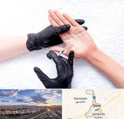 تزریق بوتاکس کف دست در قم