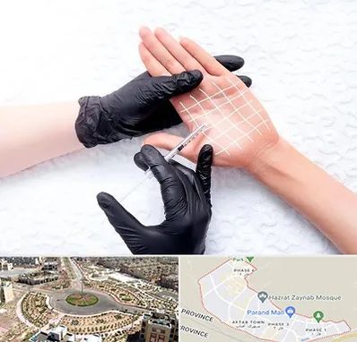 تزریق بوتاکس کف دست در پرند