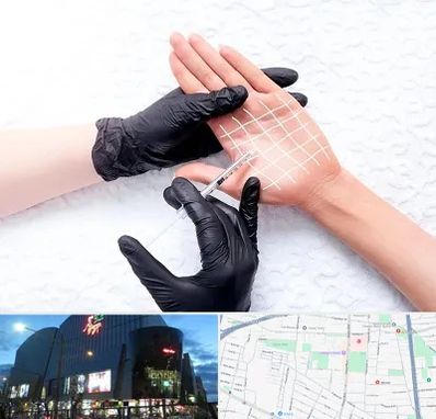 تزریق بوتاکس کف دست در بلوار اباذر