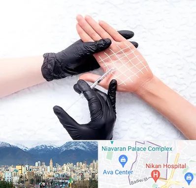 تزریق بوتاکس کف دست در آجودانیه 