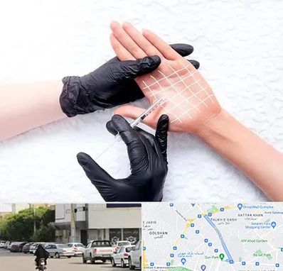 تزریق بوتاکس کف دست در قدوسی شرقی شیراز