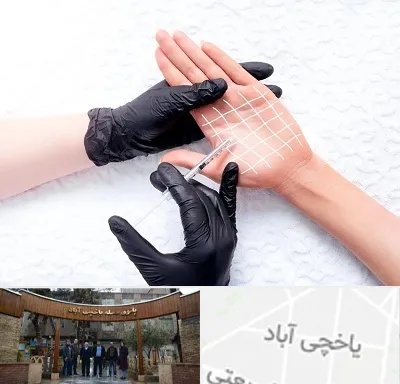تزریق بوتاکس کف دست در یاخچی آباد