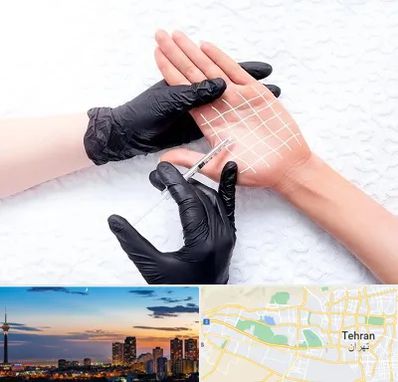 تزریق بوتاکس کف دست در غرب تهران 