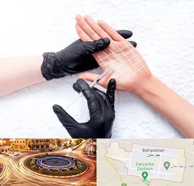 تزریق بوتاکس کف دست در بهارستان