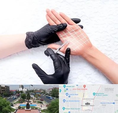 تزریق بوتاکس کف دست در بهارستان 