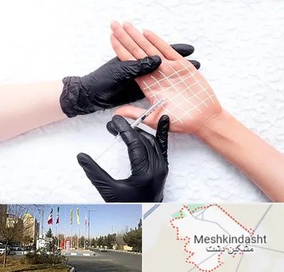 تزریق بوتاکس کف دست در مشکین دشت