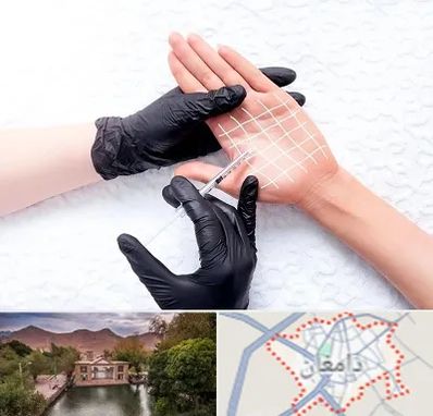 تزریق بوتاکس کف دست در دامغان