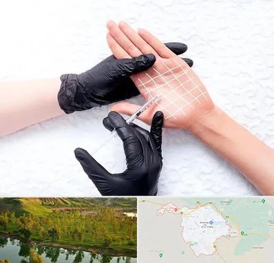 تزریق بوتاکس کف دست در بهبهان