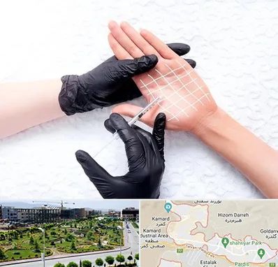 تزریق بوتاکس کف دست در پردیس