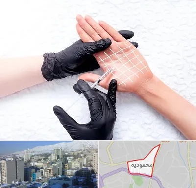 تزریق بوتاکس کف دست در محمودیه