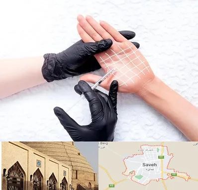 تزریق بوتاکس کف دست در ساوه