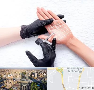 تزریق بوتاکس کف دست در استاد معین 