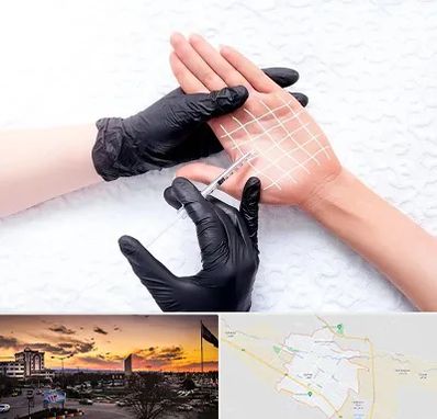 تزریق بوتاکس کف دست در قوچان