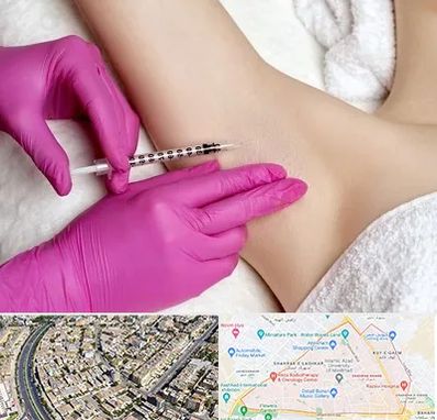 تزریق بوتاکس زیر بغل در شهرک غرب مشهد