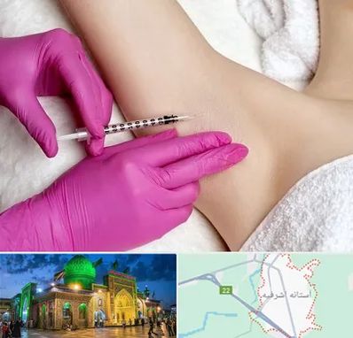 تزریق بوتاکس زیر بغل در آستانه اشرفیه