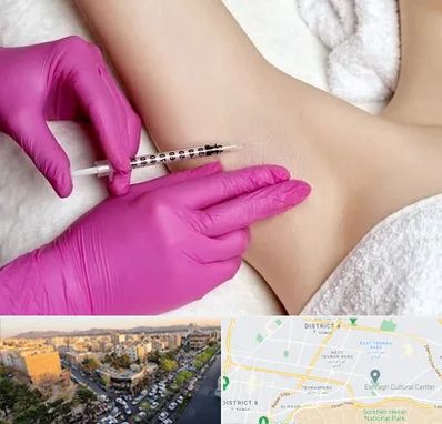 تزریق بوتاکس زیر بغل در تهرانپارس 