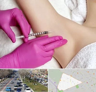 تزریق بوتاکس زیر بغل در احمدآباد مشهد