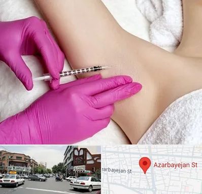 تزریق بوتاکس زیر بغل در خیابان آذربایجان