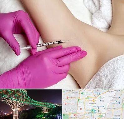 تزریق بوتاکس زیر بغل در منطقه 3 تهران 