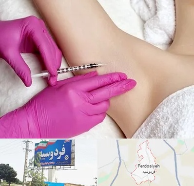 تزریق بوتاکس زیر بغل در فردوسیه شهریار