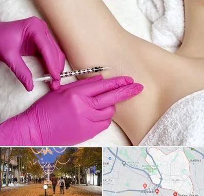 تزریق بوتاکس زیر بغل در ولیعصر ارومیه