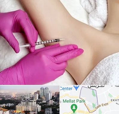 تزریق بوتاکس زیر بغل در الهیه 