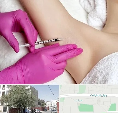 تزریق بوتاکس زیر بغل در طرشت