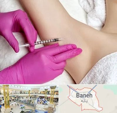 تزریق بوتاکس زیر بغل در بانه