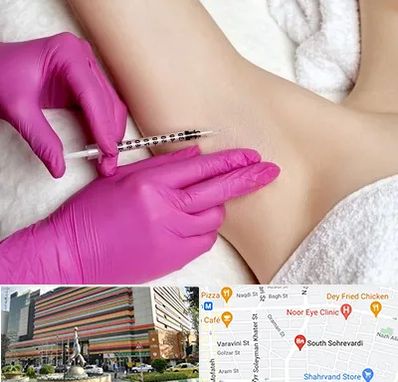 تزریق بوتاکس زیر بغل در سهروردی 