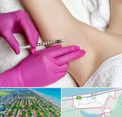 تزریق بوتاکس زیر بغل در نور