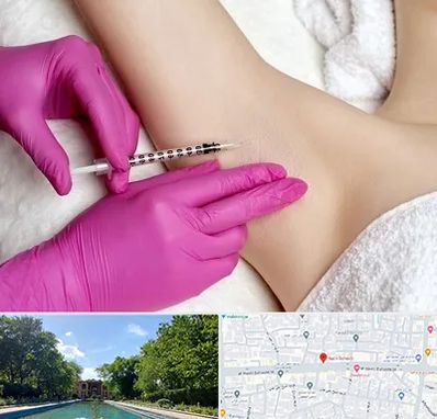 تزریق بوتاکس زیر بغل در هشت بهشت اصفهان