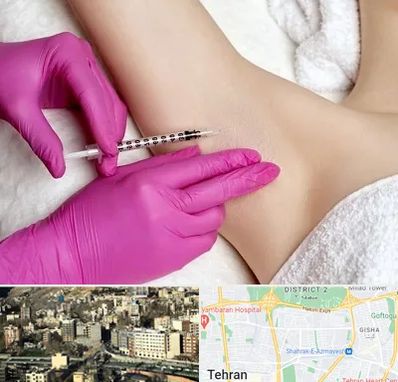 تزریق بوتاکس زیر بغل در مرزداران 