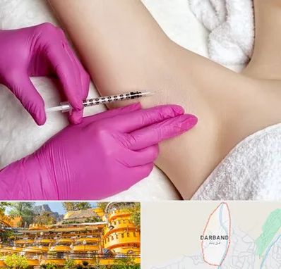 تزریق بوتاکس زیر بغل در دربند