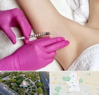 تزریق بوتاکس زیر بغل در کاشمر