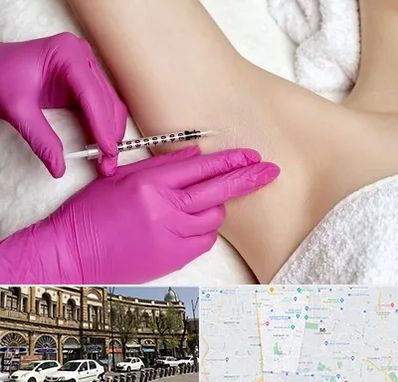 تزریق بوتاکس زیر بغل در منطقه 11 تهران 