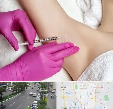 تزریق بوتاکس زیر بغل در ستارخان 