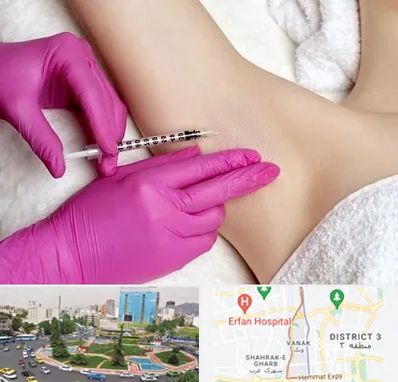 تزریق بوتاکس زیر بغل در ونک 