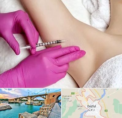 تزریق بوتاکس زیر بغل در دزفول