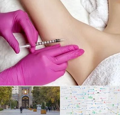 تزریق بوتاکس زیر بغل در منطقه 12 تهران 