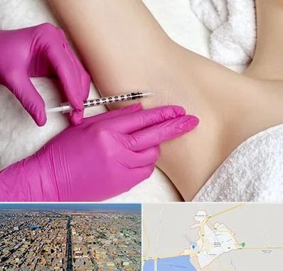 تزریق بوتاکس زیر بغل در بندر ماهشهر