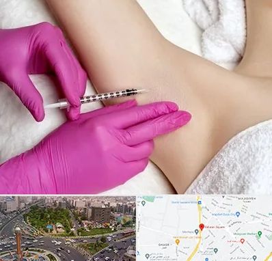 تزریق بوتاکس زیر بغل در سبلان 