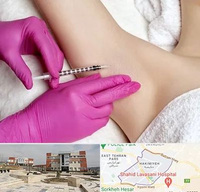 تزریق بوتاکس زیر بغل در حکیمیه 