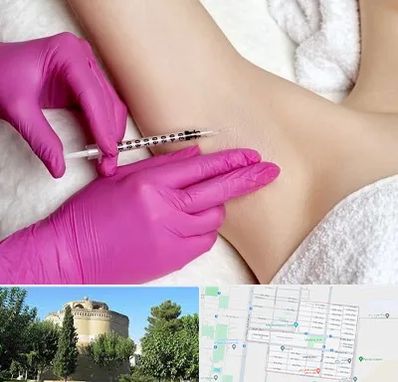 تزریق بوتاکس زیر بغل در مرداویج اصفهان