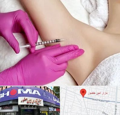 تزریق بوتاکس زیر بغل در امین حضور