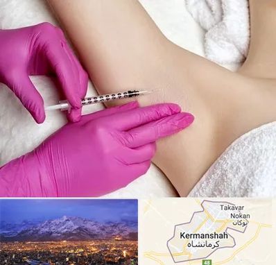 تزریق بوتاکس زیر بغل در کرمانشاه