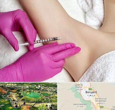 تزریق بوتاکس زیر بغل در بروجرد