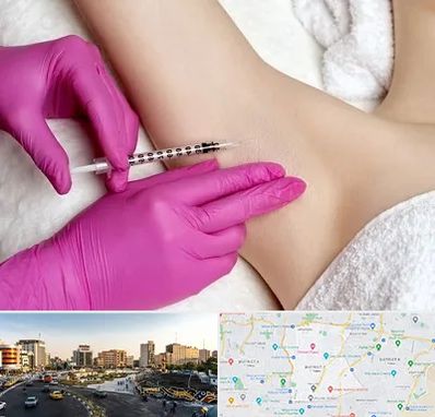 تزریق بوتاکس زیر بغل در منطقه 7 تهران 