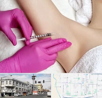 تزریق بوتاکس زیر بغل در 17شهریور