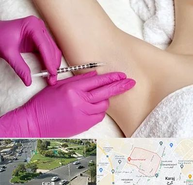 تزریق بوتاکس زیر بغل در شاهین ویلا کرج