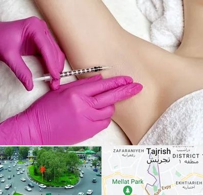 تزریق بوتاکس زیر بغل در تجریش 